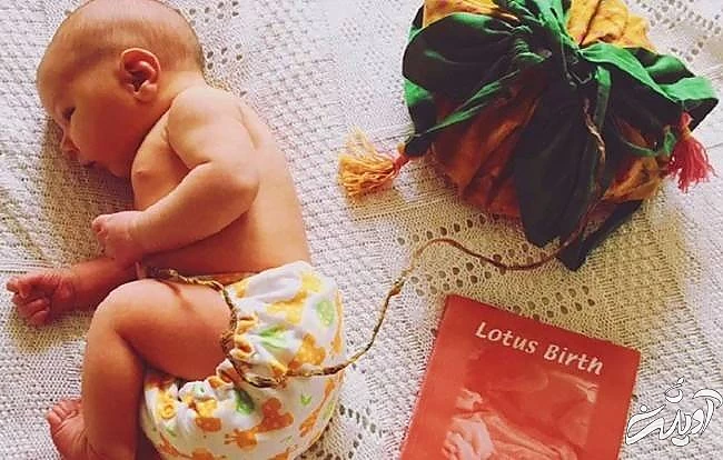 توصیه های زایمان به روش نیلوفر آبی تولد لوتوس